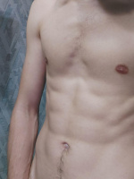 Дівчинку зі Львову – Фото 2